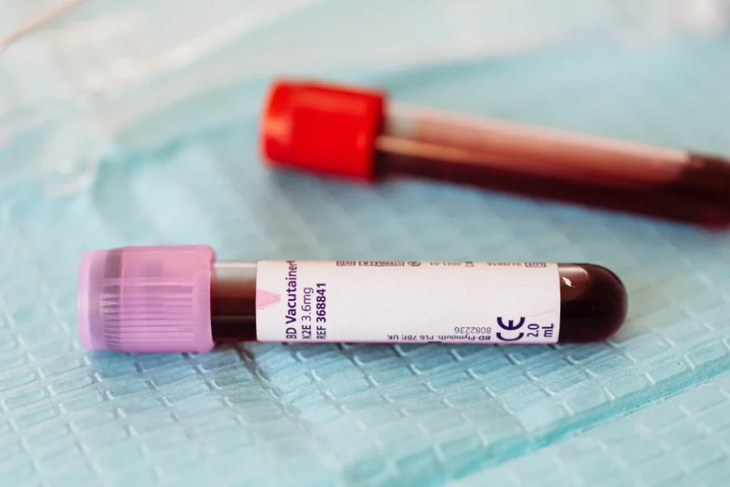 Pregnancy Blood Test Dubai