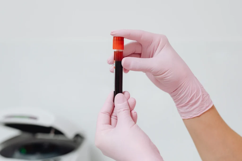 Female Fertility Testing Dubai