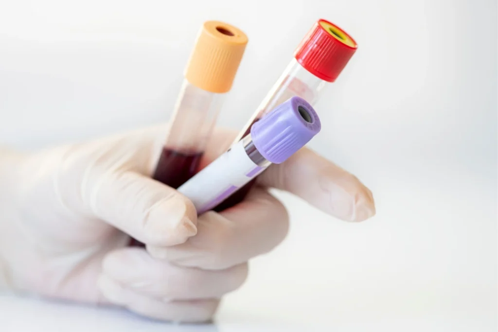 Kidney Function Tests Dubai