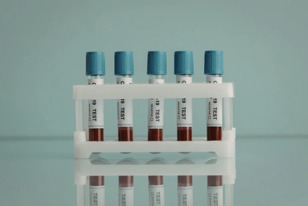 std test at home dubai