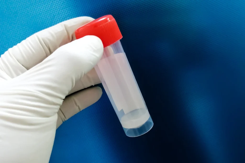 Male Fertility Testing Dubai
