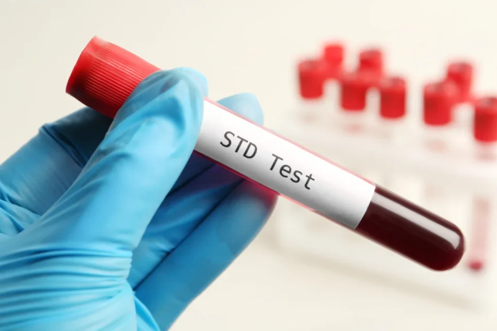 std test at home dubai