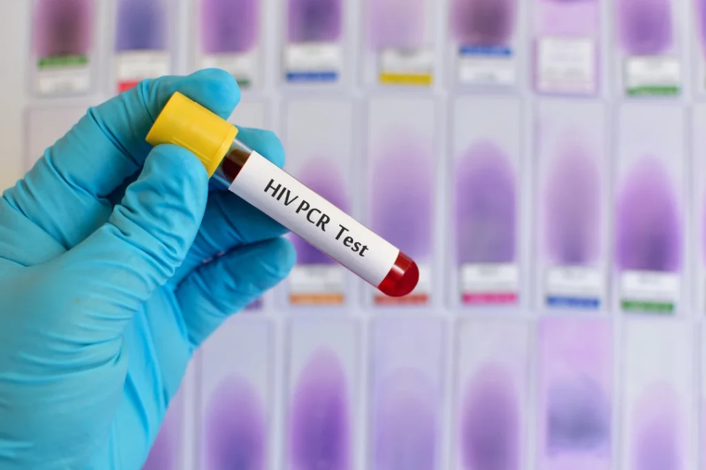 HIV Testing at Home Dubai