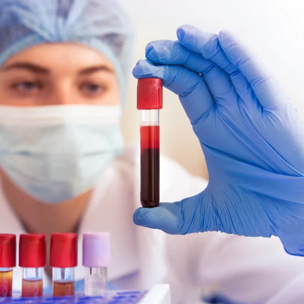 STD Test at Home Dubai